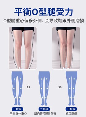 O型腿矫正鞋垫腿型直腿神器鞋跟外侧磨损X小腿足内外翻内外八字脚