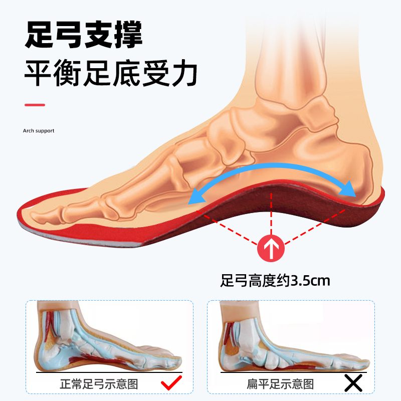 儿童扁平足足外翻矫正鞋垫内八字XO型腿小腿外翻足弓矫形鞋垫定制 - 图1