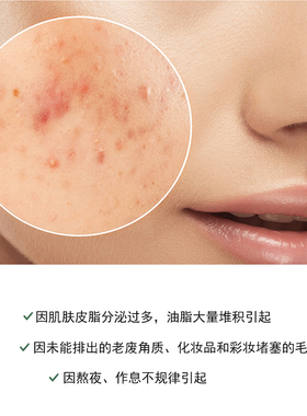 韩国舒罗蔻抹茶精华液