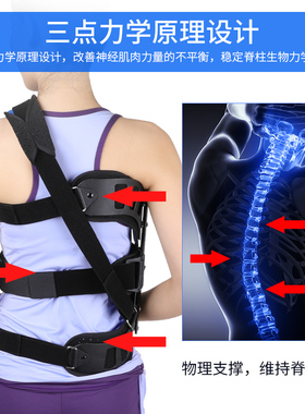 脊柱矫正器矫姿带脊椎纠正高低肩