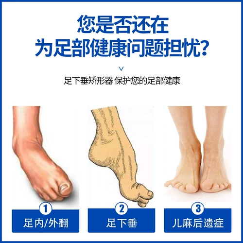 Устройство удара ногами удары по удалке, чтобы поддержать внутреннюю и снаружи ног, чтобы исправить большую ветвь корректора лодыжки, голеностопного сустава и ног