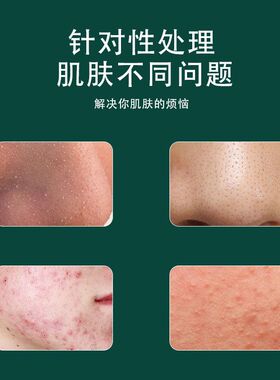 紫色针针暗疮痘痘夹细胞夹件套