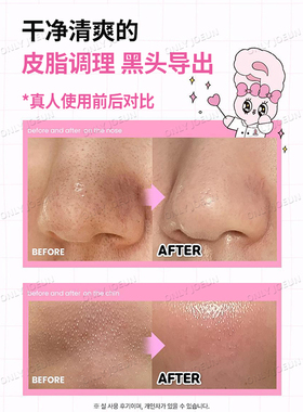 OLIVEYOUNG限定ILSO黑头导出液