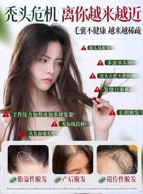 侧柏叶洗发水控油蓬松去屑止痒