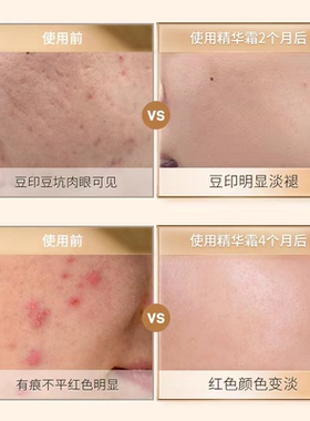 裂博山茶籽油抗裂修护保湿精华霜