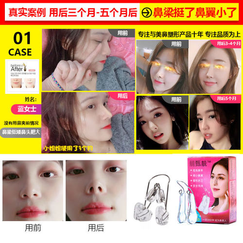 鼻梁增高器鼻子增高矫正器鼻夹挺鼻器瘦鼻子变小缩小鼻翼美鼻神器 - 图1