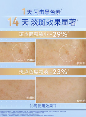 妮维雅630淡斑精华液美白30ml