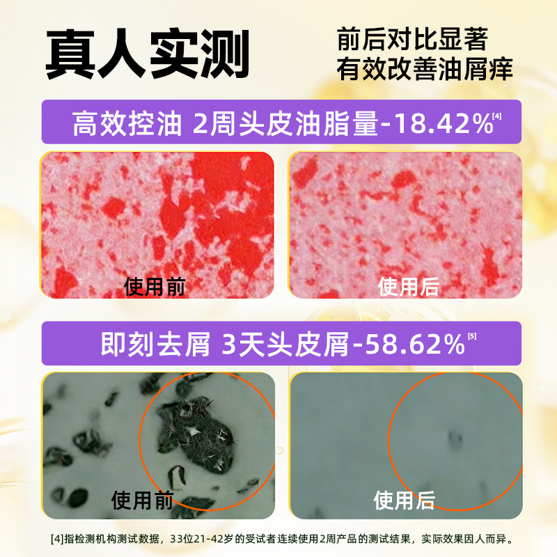 臻选浅香小蓬友氨基酸洗发水礼盒套装控油肽专利蓬松去屑持久留香