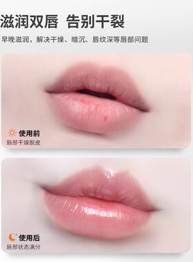 百蕾适小蓝罐北美护唇热销80国