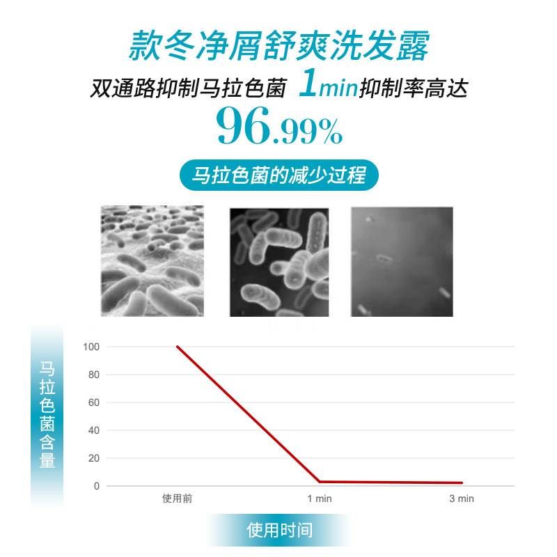 域发洗发水款冬去屑止痒洗发露洗头膏300ml去屑蓬松清爽持久