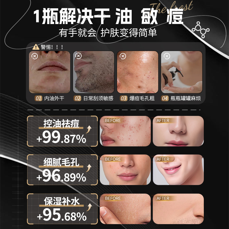 PCA锌男士乳面霜控油祛痘保湿补水收缩毛孔护肤品官方正品店旗舰 - 图1