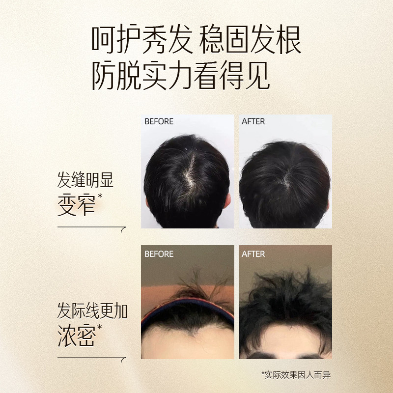 云南白药养元青防脱洗发水控油洗发露500ml+100ml*2--下拉更优惠