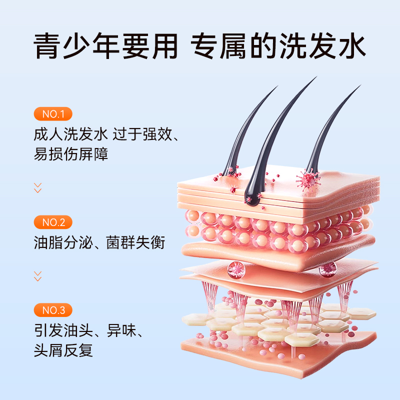 亲初青少年植物去屑洗发水儿童止痒控油洗发露中大童男女孩无添加