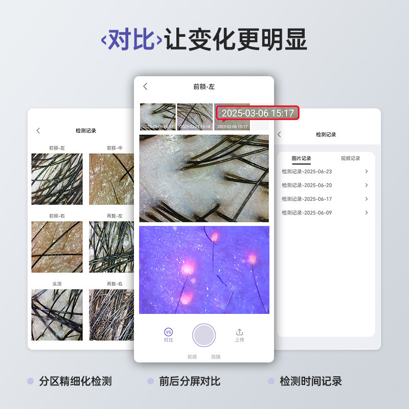 Mriya麦蕊雅头皮毛囊检测仪便携家用高清头发毛孔皮肤放大镜仪器,淘宝优惠券,粉丝福利购,淘宝优惠卷