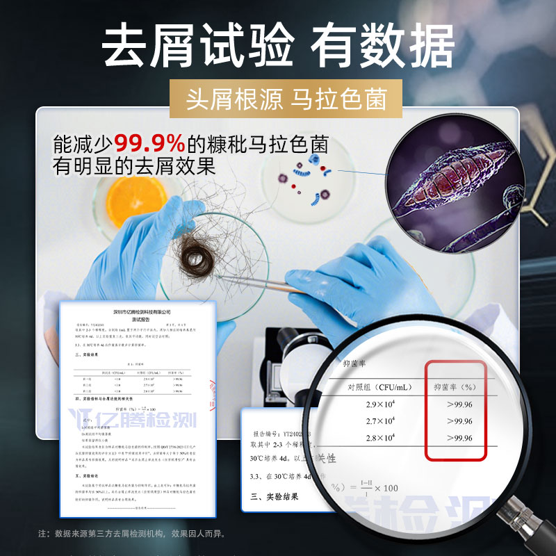酮康采乐去屑洗发水200ml止痒蓬松柔顺便携洗发露滋养洗头膏正品