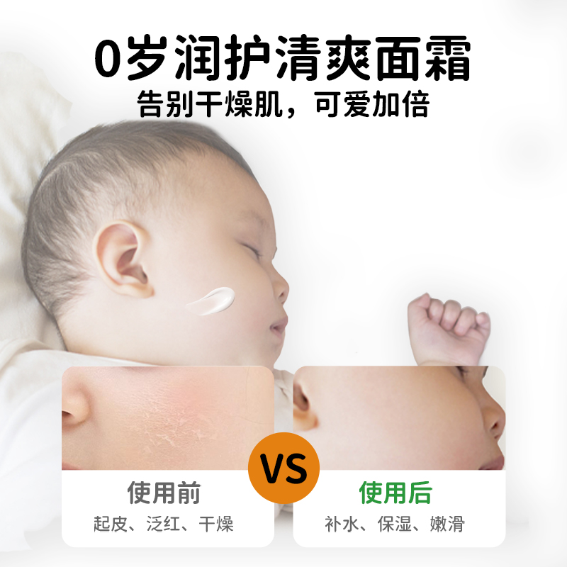 麦康婴幼儿金盏花面霜四季宝宝霜保湿补水滋润清爽春夏儿童面霜香