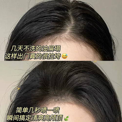 spes干发喷雾免洗蓬松诗裴丝喷雾头发神器干爽空气感蓬蓬粉高颅顶 - 图2