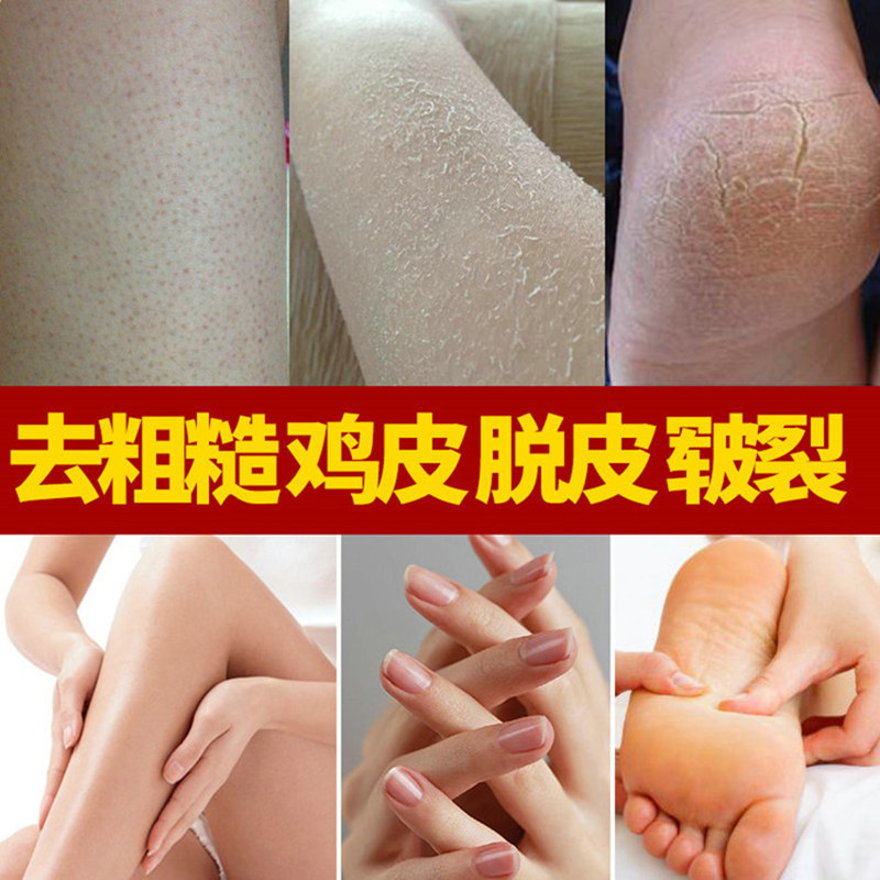 谷幽兰维他命甘油蜜纯正品秋冬补水滋润全身身体乳保湿防裂护肤油 - 图1