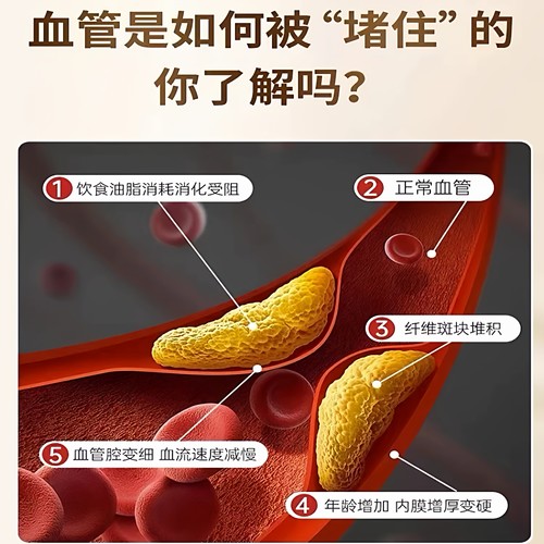 日本进口强力纳豆激酶5000FU胶囊改善保护心溶栓脑血管畅通高活性 - 图2