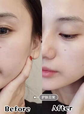 OLAY玉兰油美白淡斑精华液olay抗糖小白瓶第四代only老款精华欧蕾
