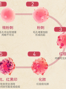 老中医化妆品痘清套装系列