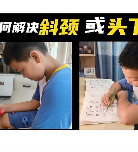 童颈托斜颈偏头儿童颈托斜颈偏头