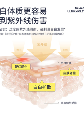 盖百霖隔离紫外线保护白斑皮肤
