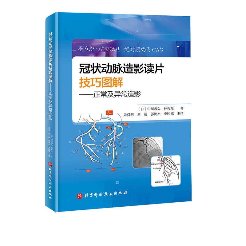 冠状动脉造影读片技巧图解 正常及异常造影 教你从冠脉造影小白 快速进阶PCI达人 日本畅销视频版 扫码免费看视频 北京科学技术 - 图0