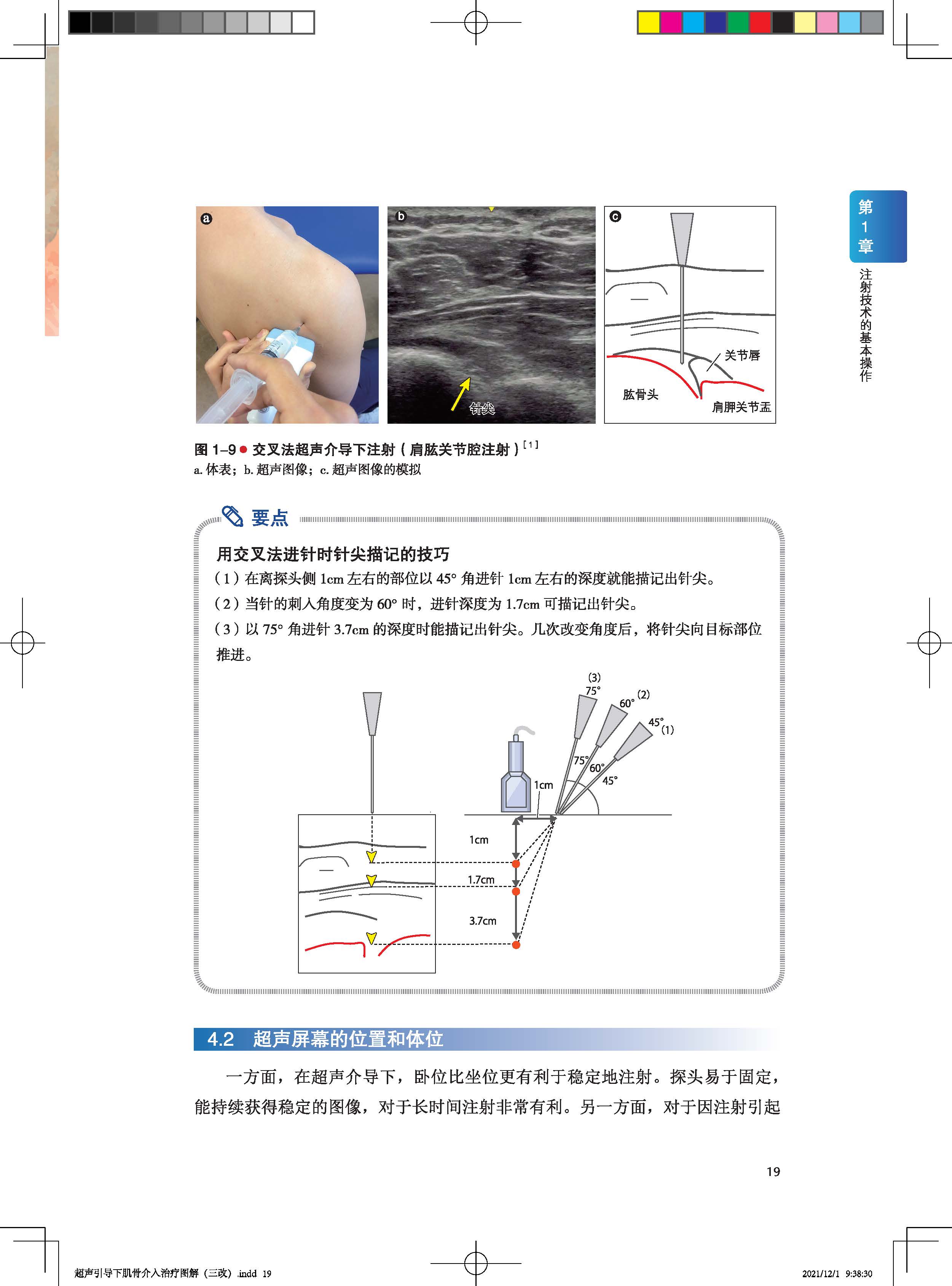 超声引导下肌骨介入治疗图解 日系经典视频版 手把手教你快速掌握 超声引导下肌骨介入治疗 影像医学 超声 麻醉 康复 骨科 - 图1