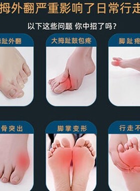 拇外翻矫正器通用大脚趾
