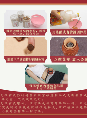 小儿推拿肚脐灸工具艾中医