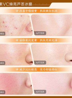 瑜然美虾青素vc焕亮芦荟冰膜免洗
