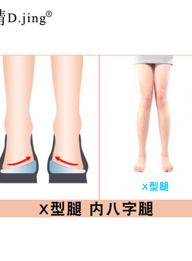 硅胶O型腿矫正鞋垫男女春X型腿内外八字后跟垫儿童学生足内外翻