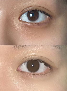 日本晓姿AXXZIA4D金字塔眼膜提升紧致淡纹甩掉黑眼圈眼袋60片/罐