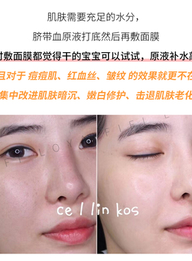 韩国cellinkos脐带血修护精华