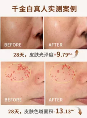 顺丰【薄皮易红天选精华】Cech瑟伊科藏红花精华 玫瑰脂皮舒敏