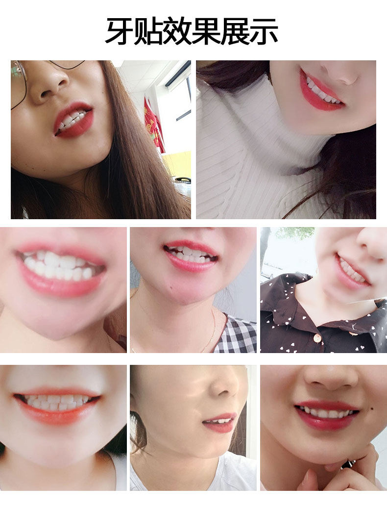  沁宜家居牙齿美白脱色剂