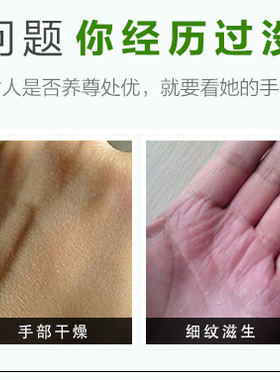 德国herbacin贺本清75ml小甘菊
