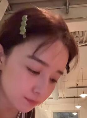 侧边夹子醋酸亚克力刘海碎发夹子