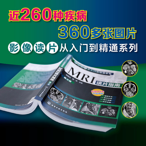 影像读片从入门到精通系列 MRI读片指南第三版 影像学诊断超声图谱医学诊断学检查技术基础教程 强化思路技巧病种齐全病例典型图片 - 图0