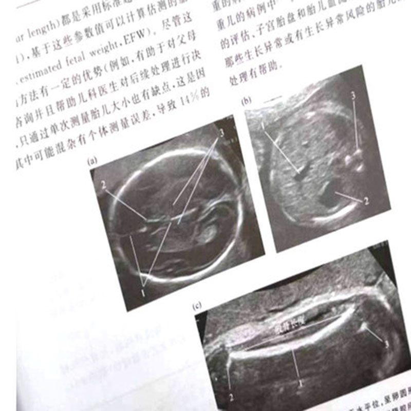 杜赫斯特精装第9版产科学正常妊娠 馨园青图书妇产科学