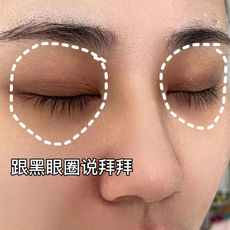 Машина спа 春日井vc紧致精华眼霜 缓解水肿 淡化眼袋 补水保湿改善黑眼圈