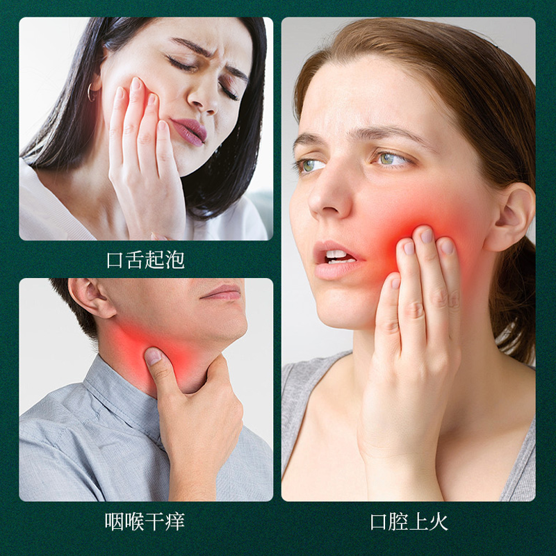 两面针新四味针火草本洁白植物口腔健康清新口气清火去火牙膏套装,淘宝优惠券,粉丝福利购,淘宝优惠卷