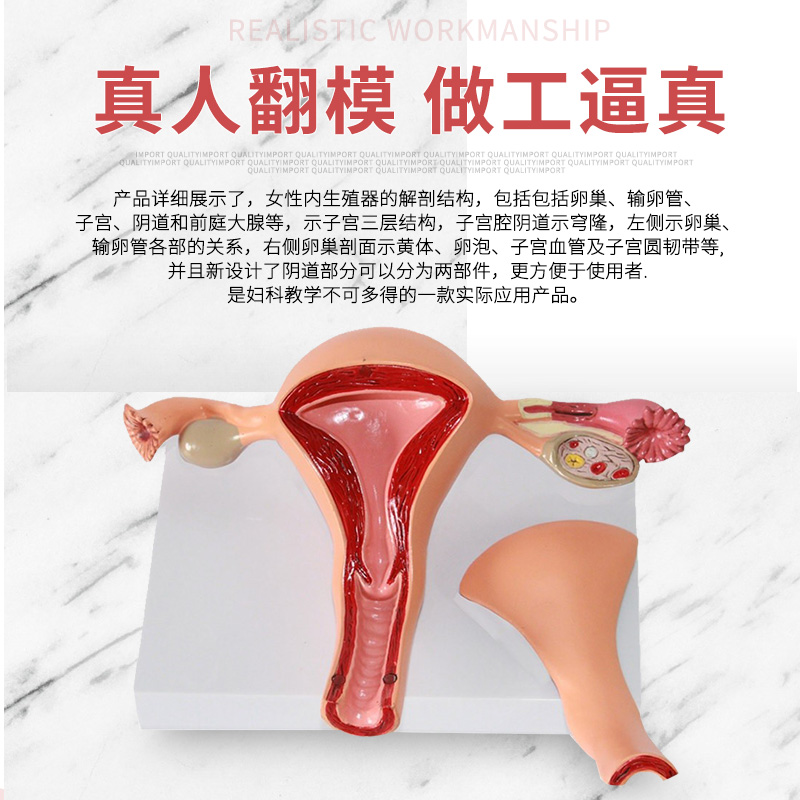 子宫、卵巢f病理病变模型生殖科医药礼品模型女性子宫阴道模型 - 图2