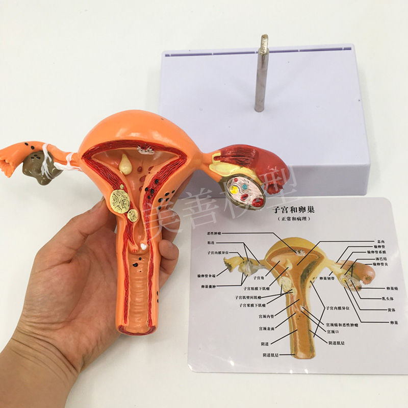 人体模型女性生殖子宫模型阴道卵巢模型教学模具病理变化科普妇科 - 图0