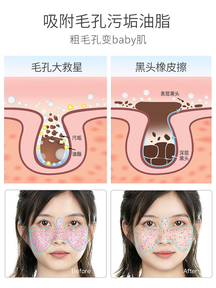 eiio深层清洁泥膜去黑头粉刺闭口控油收缩毛孔男女学生涂抹式面膜 - 图1