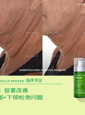 慕拉得A醛精华改善毛孔淡化细纹