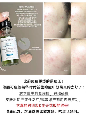 修丽可色修精华植萃舒缓镇定去红淡化痘印保湿修护亮妍精华露30ml