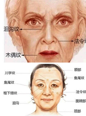 百草法令纹精油改善表情纹川字纹