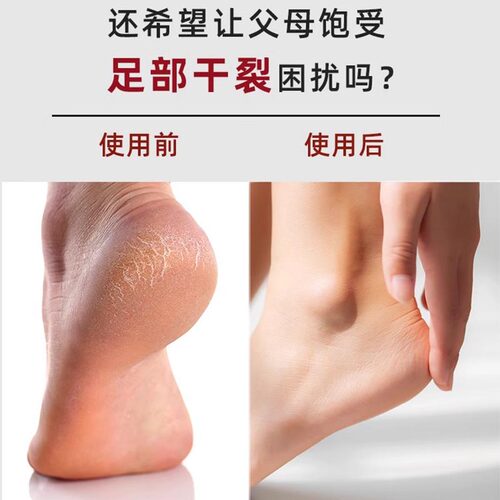紫彦防裂袜子脚裂袜男女棉袜脚后跟干裂老人足跟防裂袜冬季足裂袜 - 图0